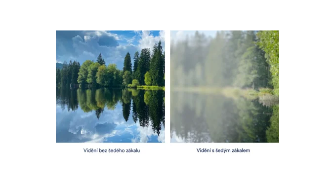 Poruchy zraku: Jak je vidí lidé s omezeným zrakem?